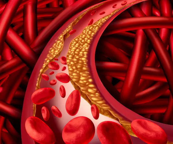 DOENÇA ARTERIAL CORONÁRIA, CEREBRAL OU PERIFÉRICA